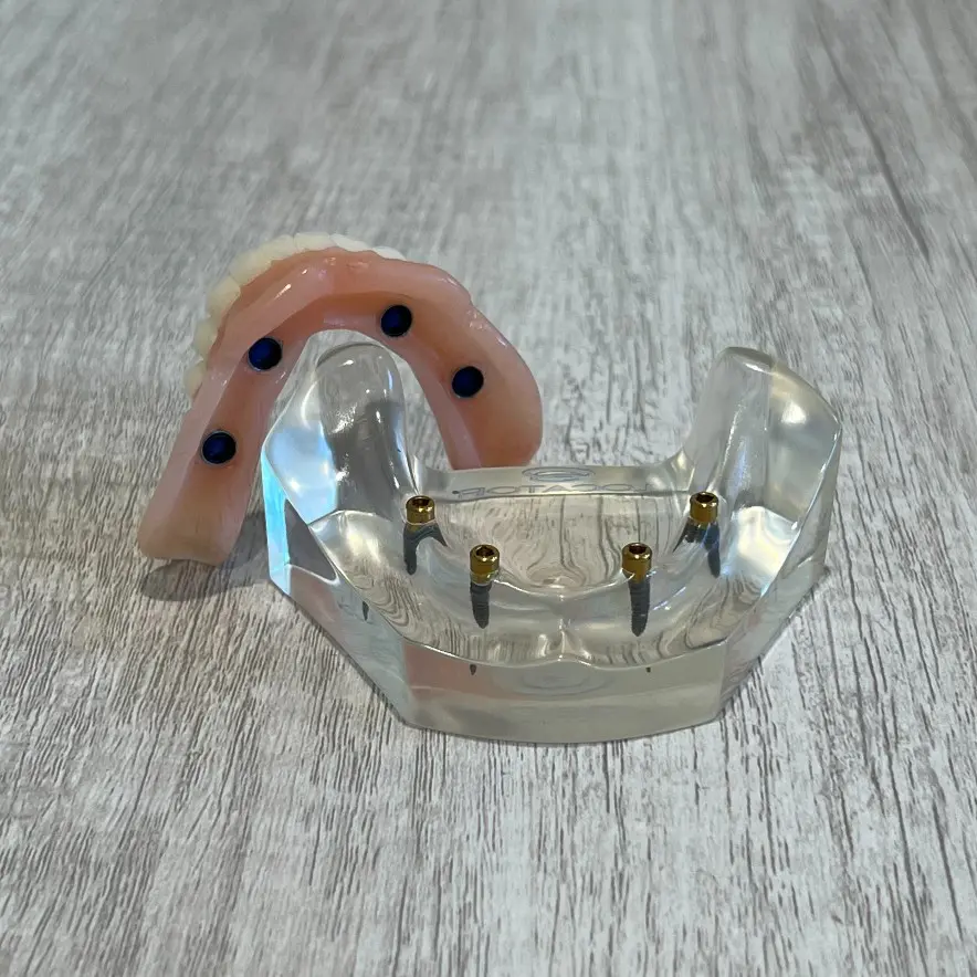 snap-in implant dentures Vista, CA